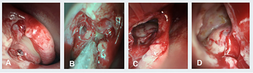 Figure 4